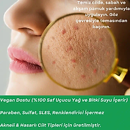 ANTI-ACNE SERUM Akne Karşıtı Yüz Serumu